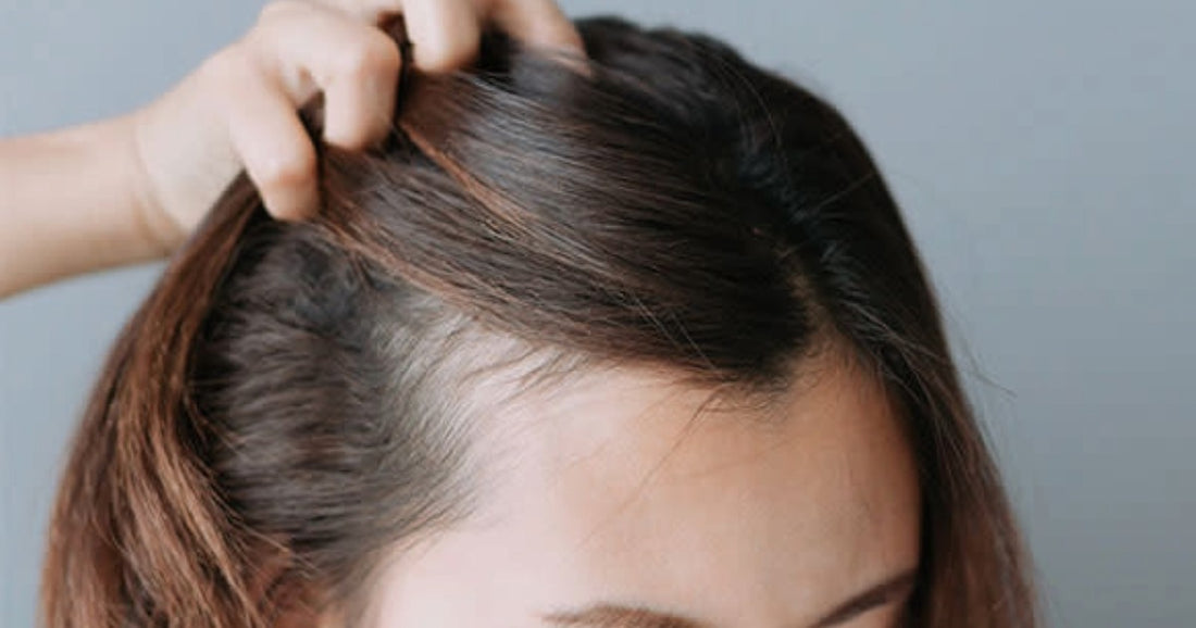 How to Identify and Treat Postpartum Hair Loss